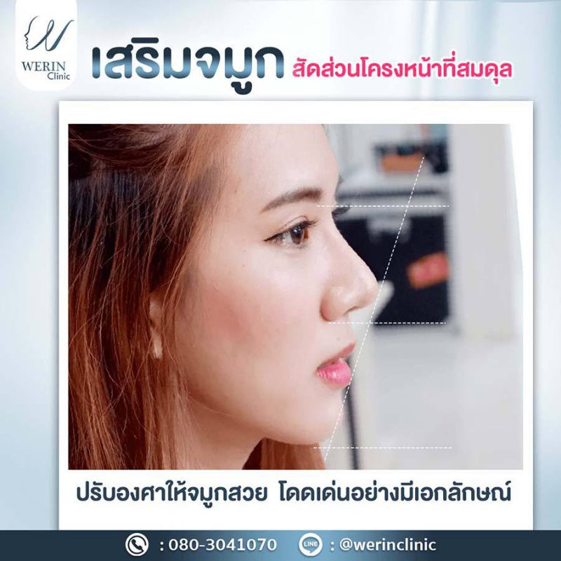 รีวิวจมูกผญ32web