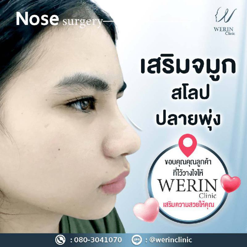 รีวิวจมูกผญ33web