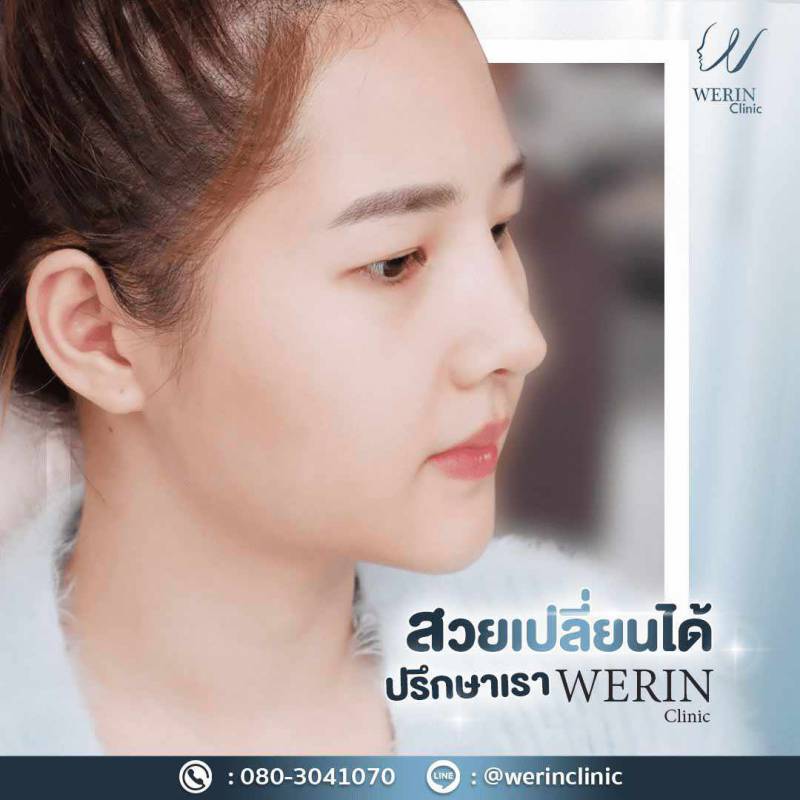 จมูกผญweb