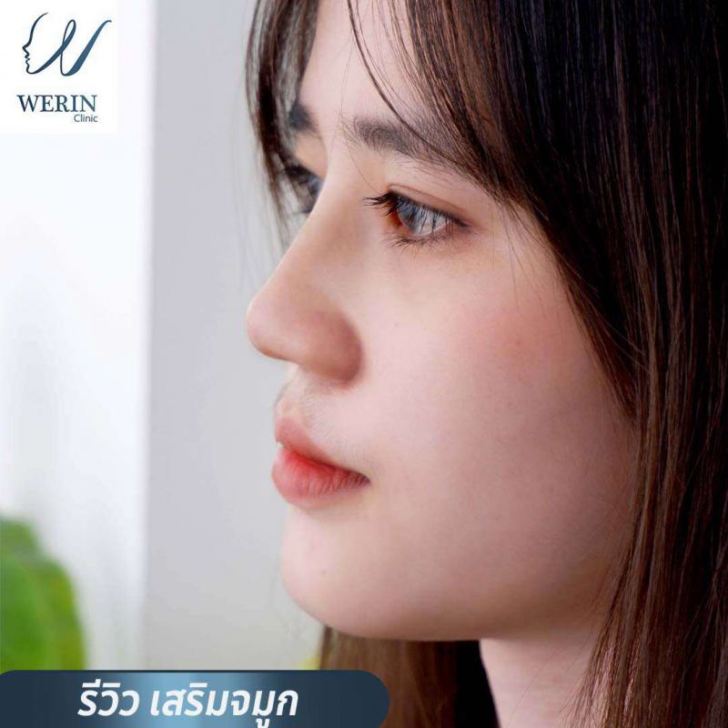 รีวิวจมุกผญ23web