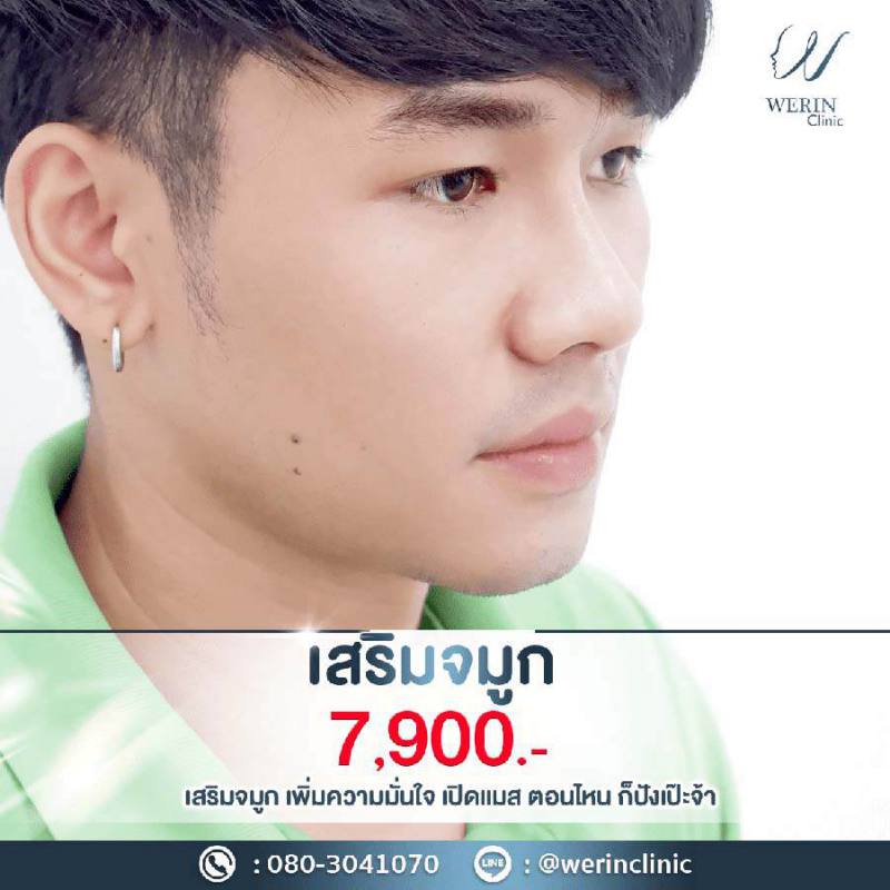 รีวิวจมูกผช27web