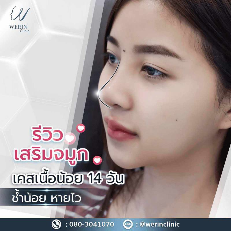 รีวิวจมูกผญ27web