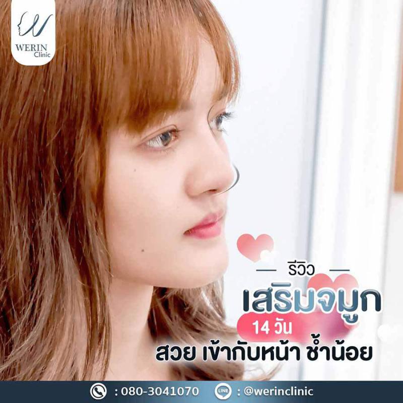 รีวิวจมูกผญ29web