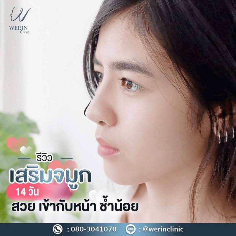 รีวิวจมูกผญ30web