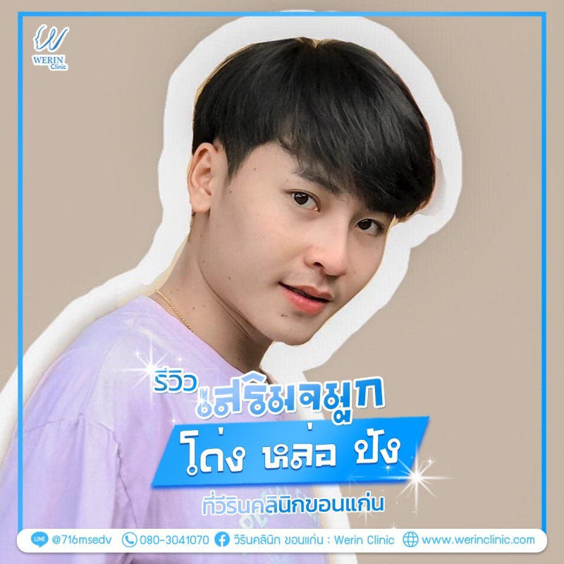 รีวิวจมูกผู้ชาย_๒๑๐๘๑๑_22