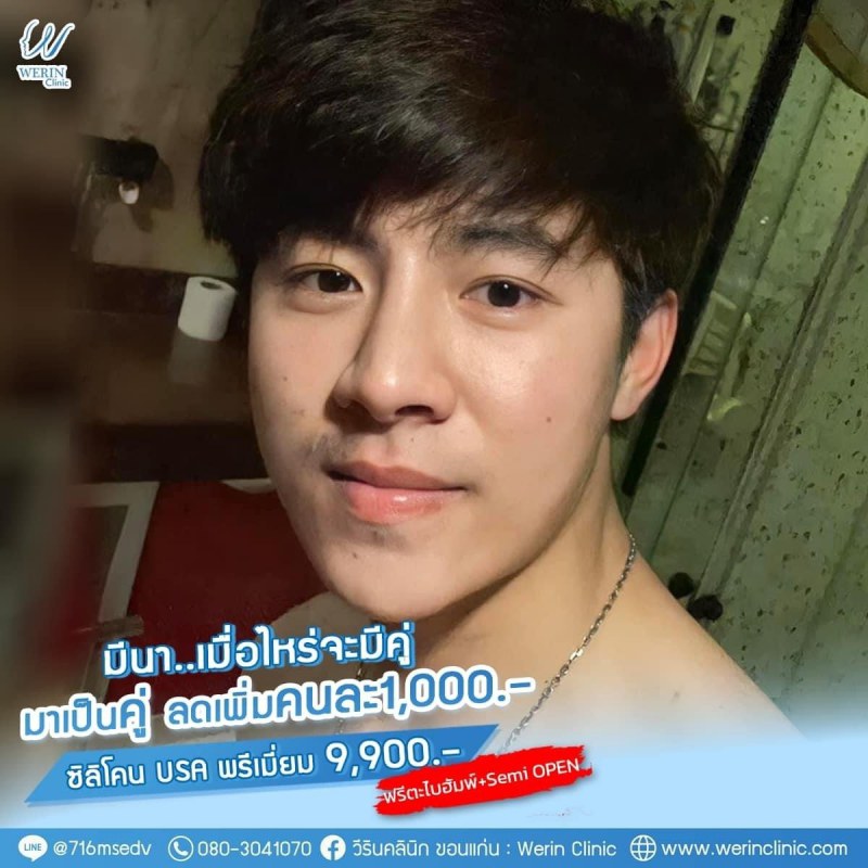 รีวิวจมูกผู้ชาย_๒๑๐๘๑๑_31