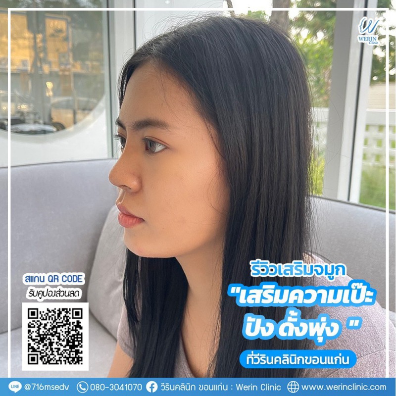 รีวิวจมูกผู้หญิง_๒๑๐๘๑๐_33