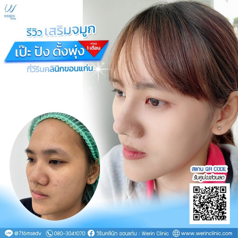 รีวิวจมูกผู้หญิง_๒๑๐๘๑๐_34