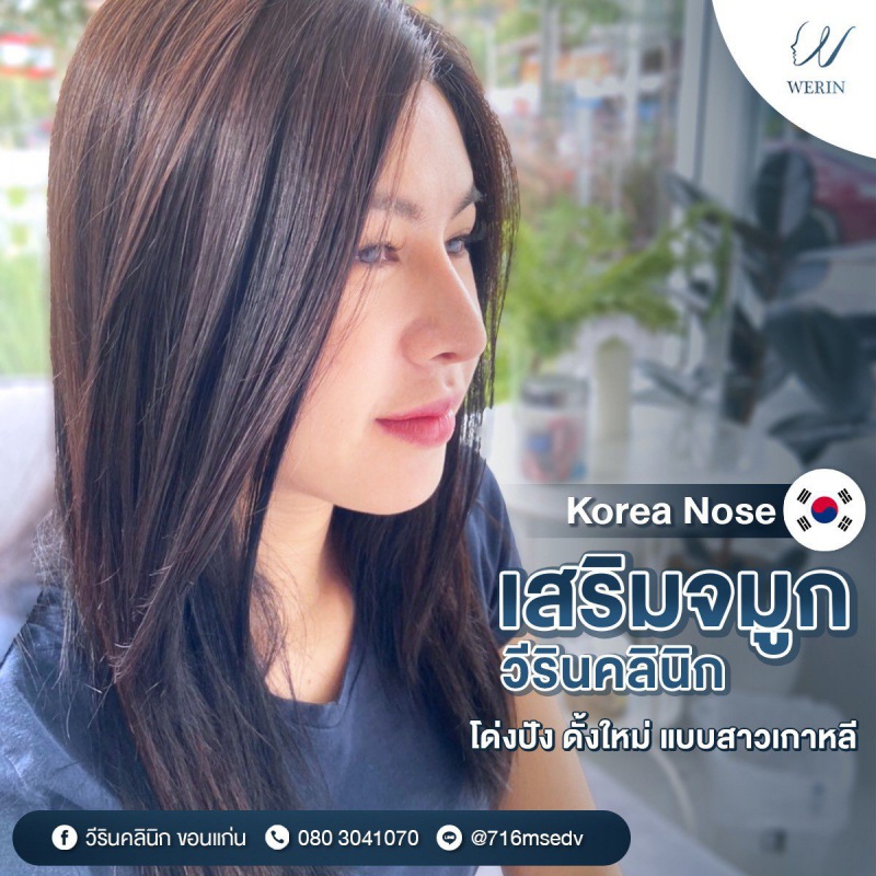 รีวิวจมูกผู้หญิง_๒๑๐๘๑๐_35