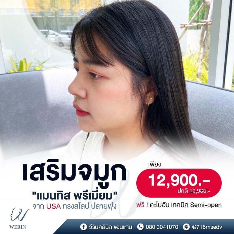 รีวิวจมูกหน้าแรก_๒๑๐๘๑๑_12