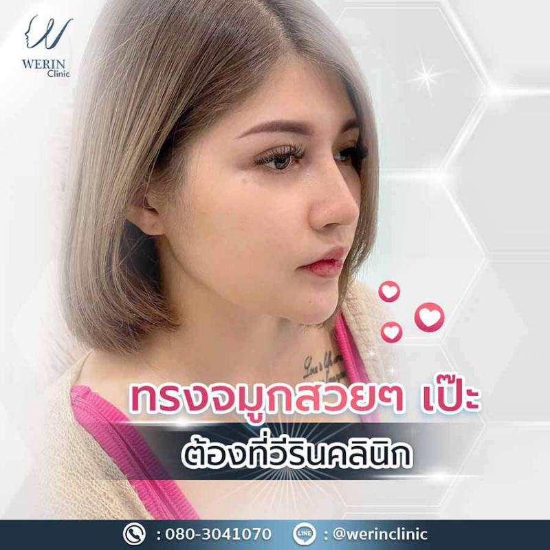 รีวิวจมูก28web